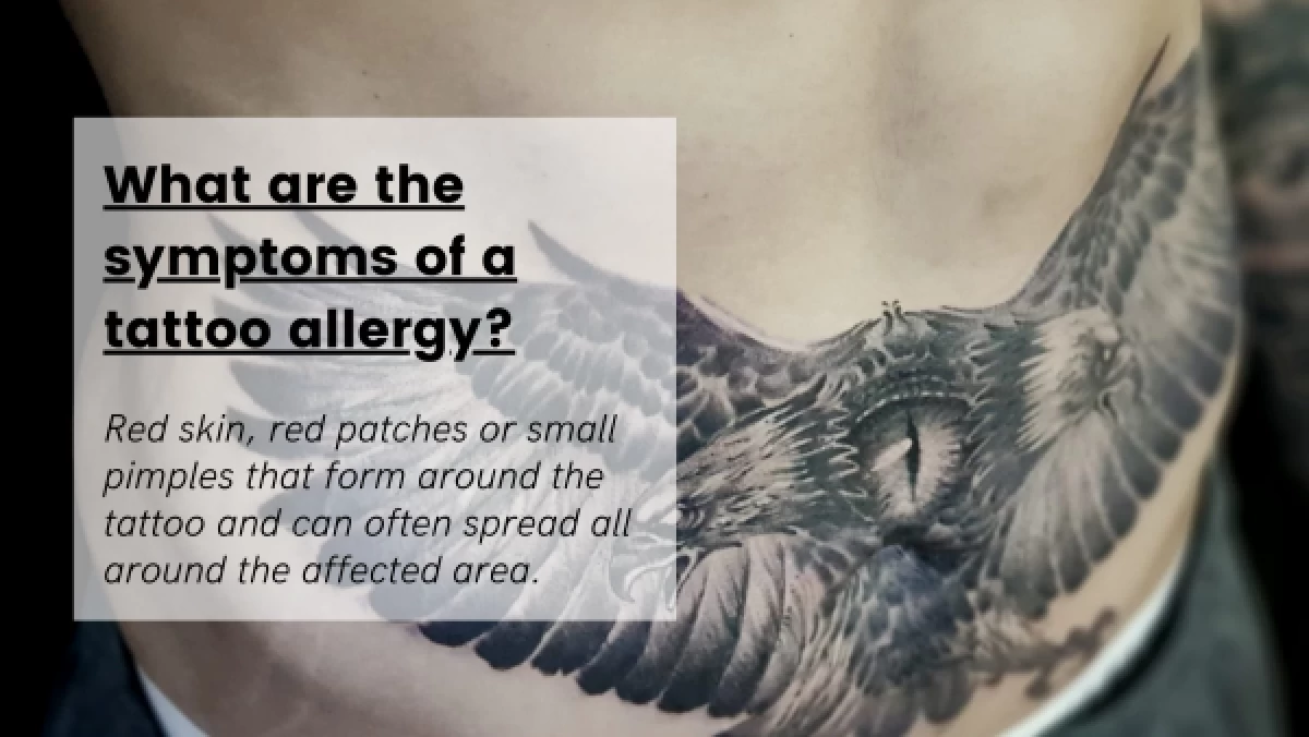 What-are-the-symptoms-of-a-tattoo-allergy_-600x338