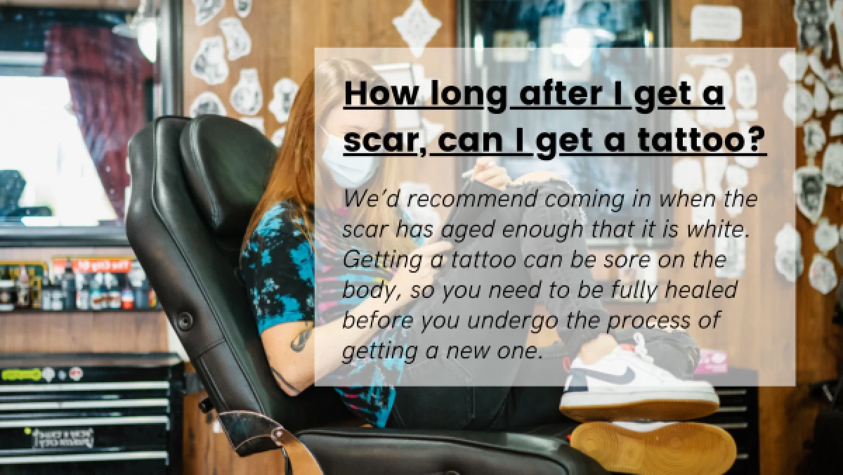How-long-after-I-get-a-scar-can-I-get-a-tattoo_-600x338