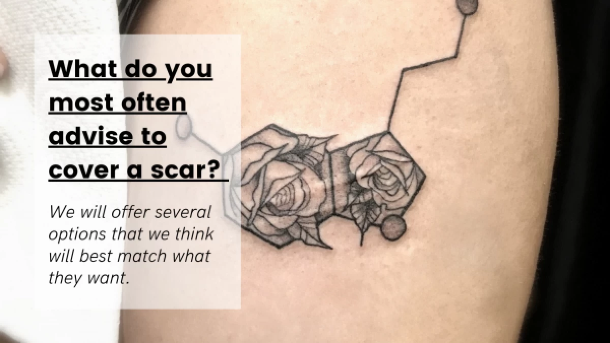 What-do-you-most-often-advise-your-customers-to-do-when-they-ask-to-cover-their-scar-with-a-tattoo_--600x338