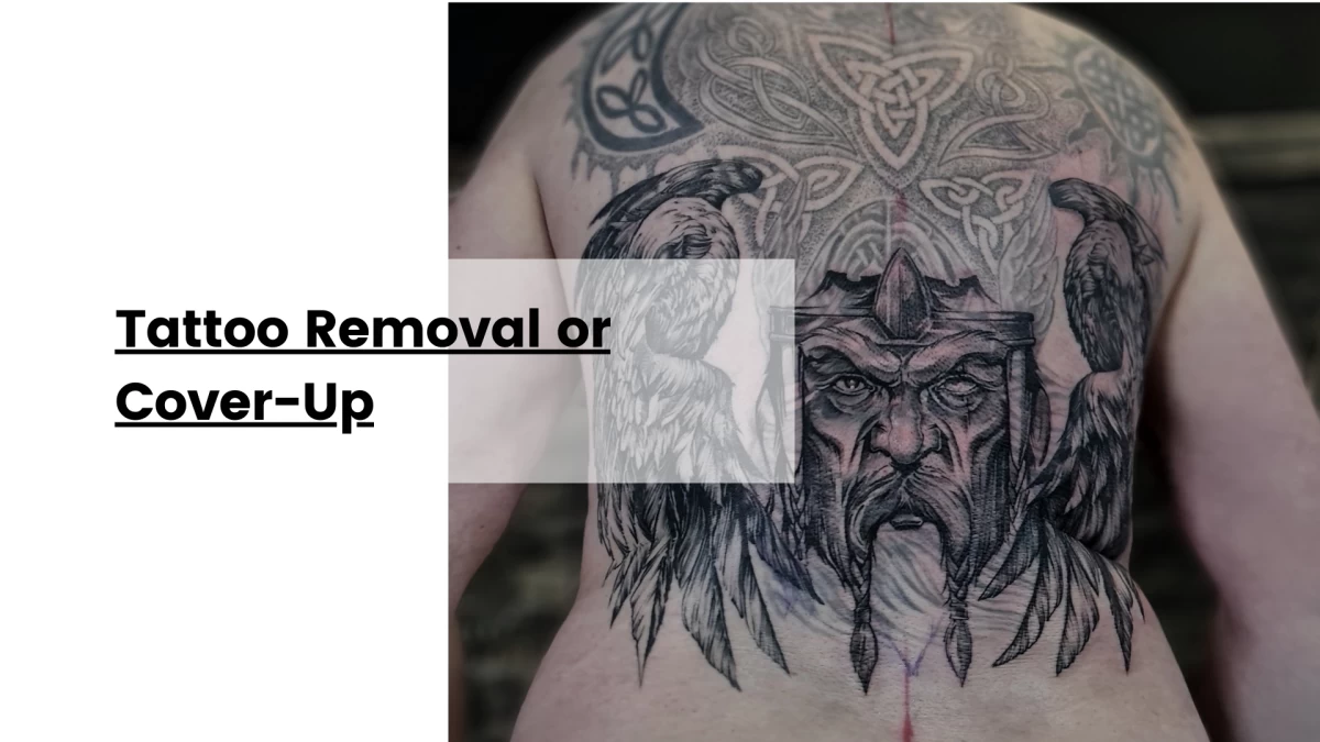 We Have the Solution_ Tattoo Removal or Cover-Up