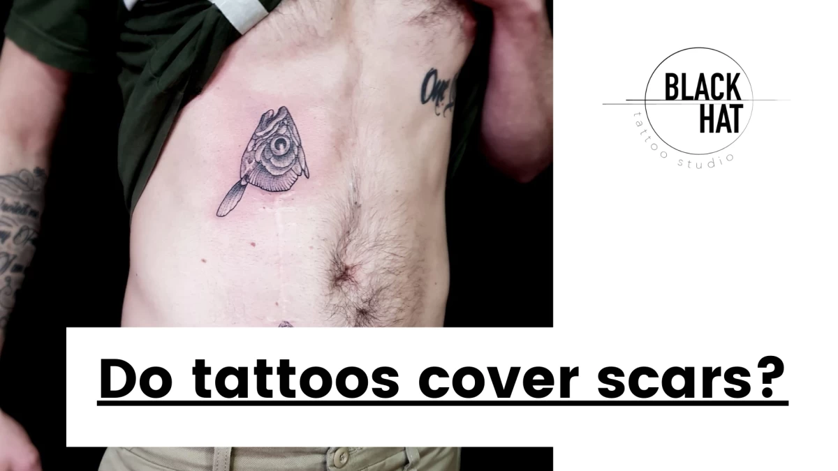 Do tattoos cover scars (2)