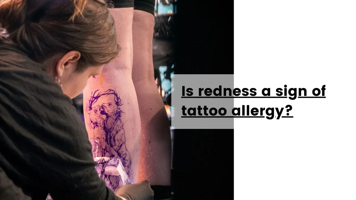 Is redness a sign of tattoo allergy