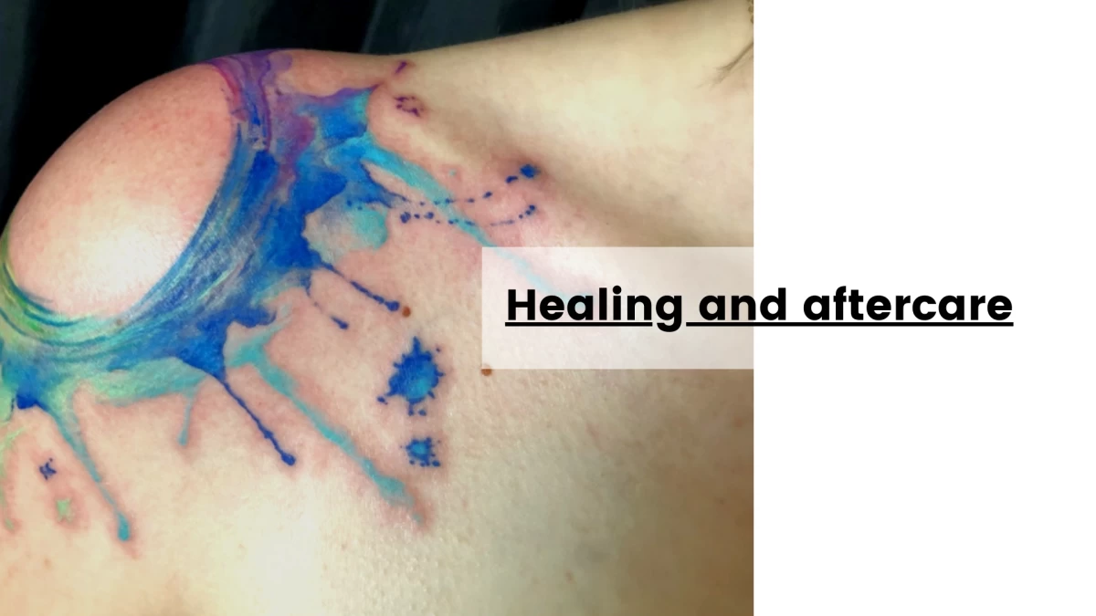 Healing and aftercare